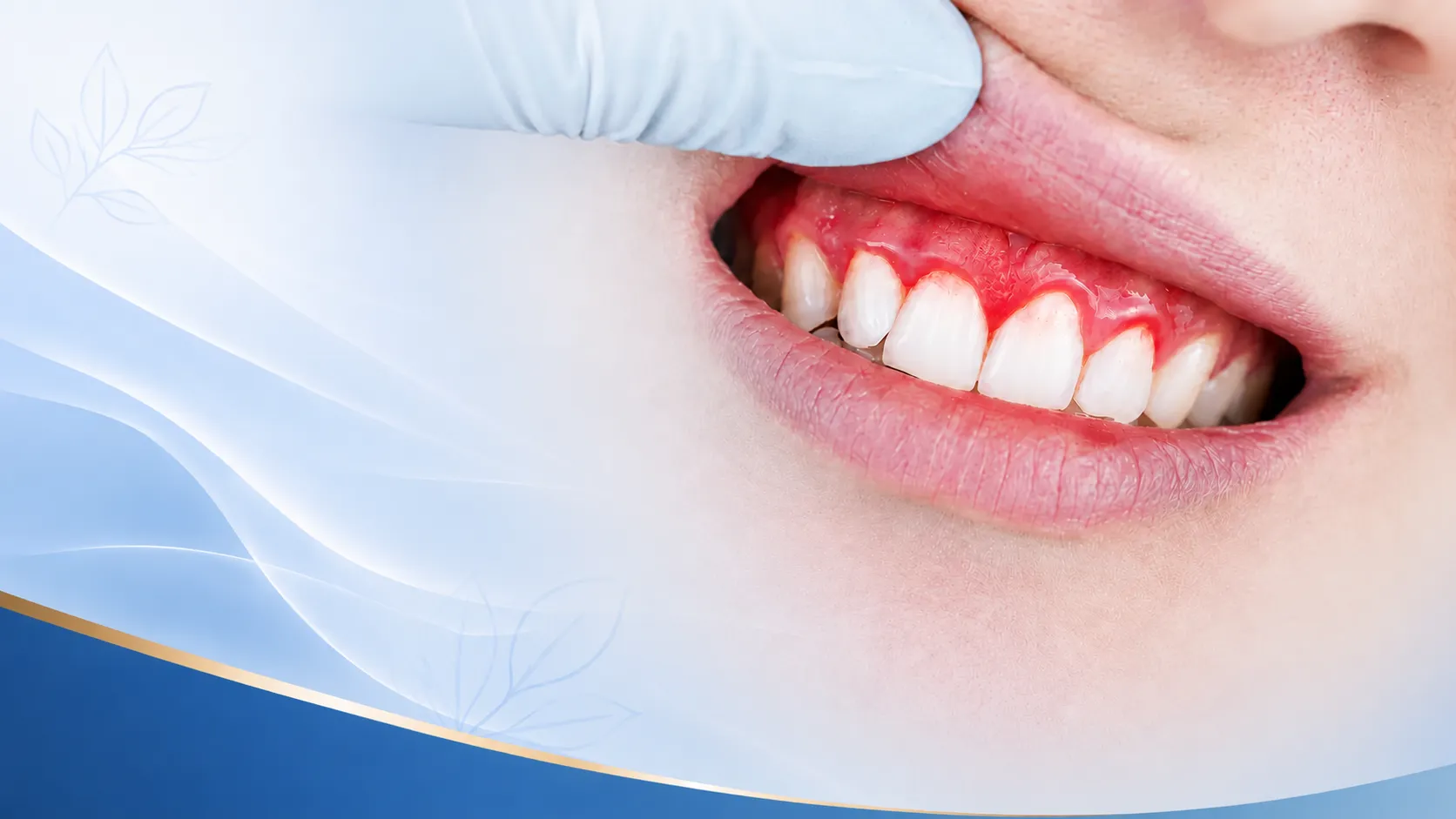 Periodontal Care