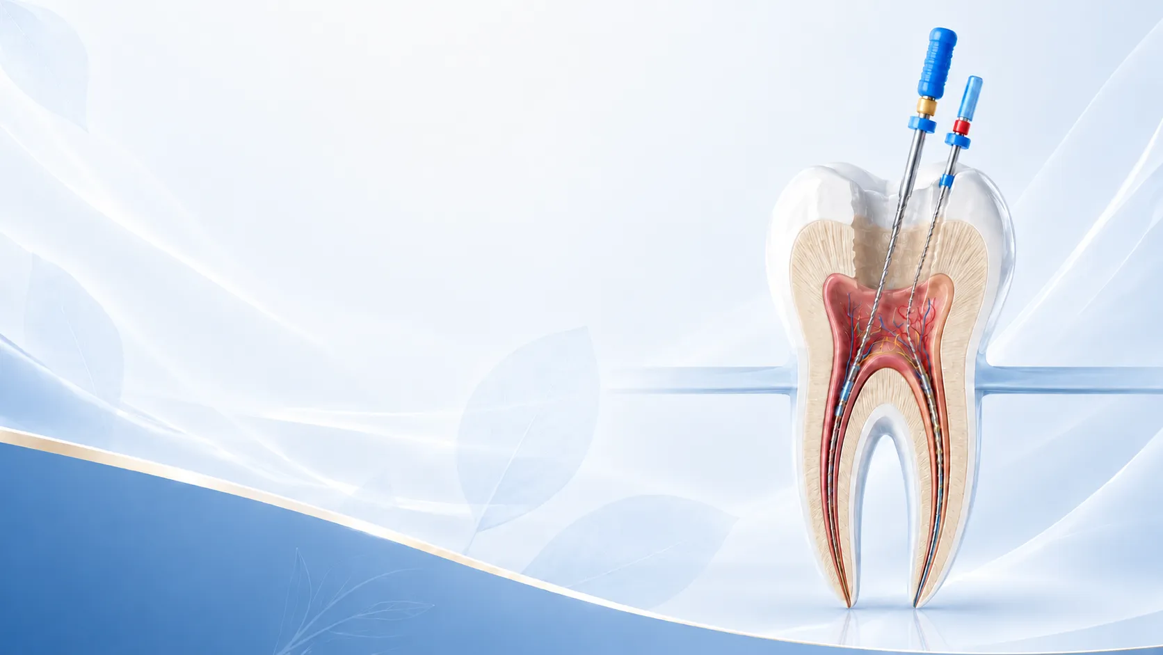 Endodontic Therapy (Root Canals)